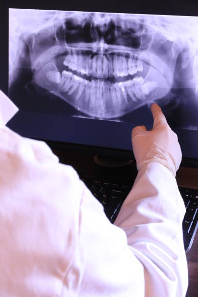 Best Emergency Root Canal Therapy in Quinlan, TX