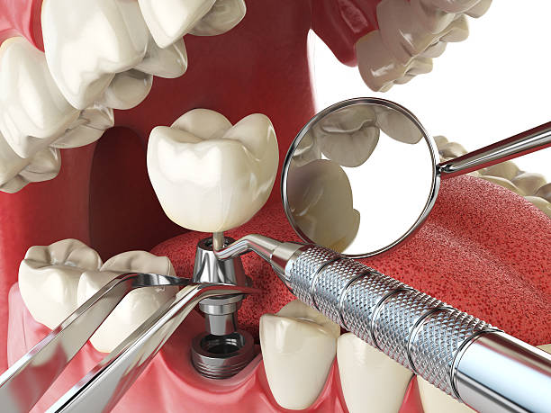 Best Emergency Treatment for Jaw Pain or Injury in Quinlan, TX
